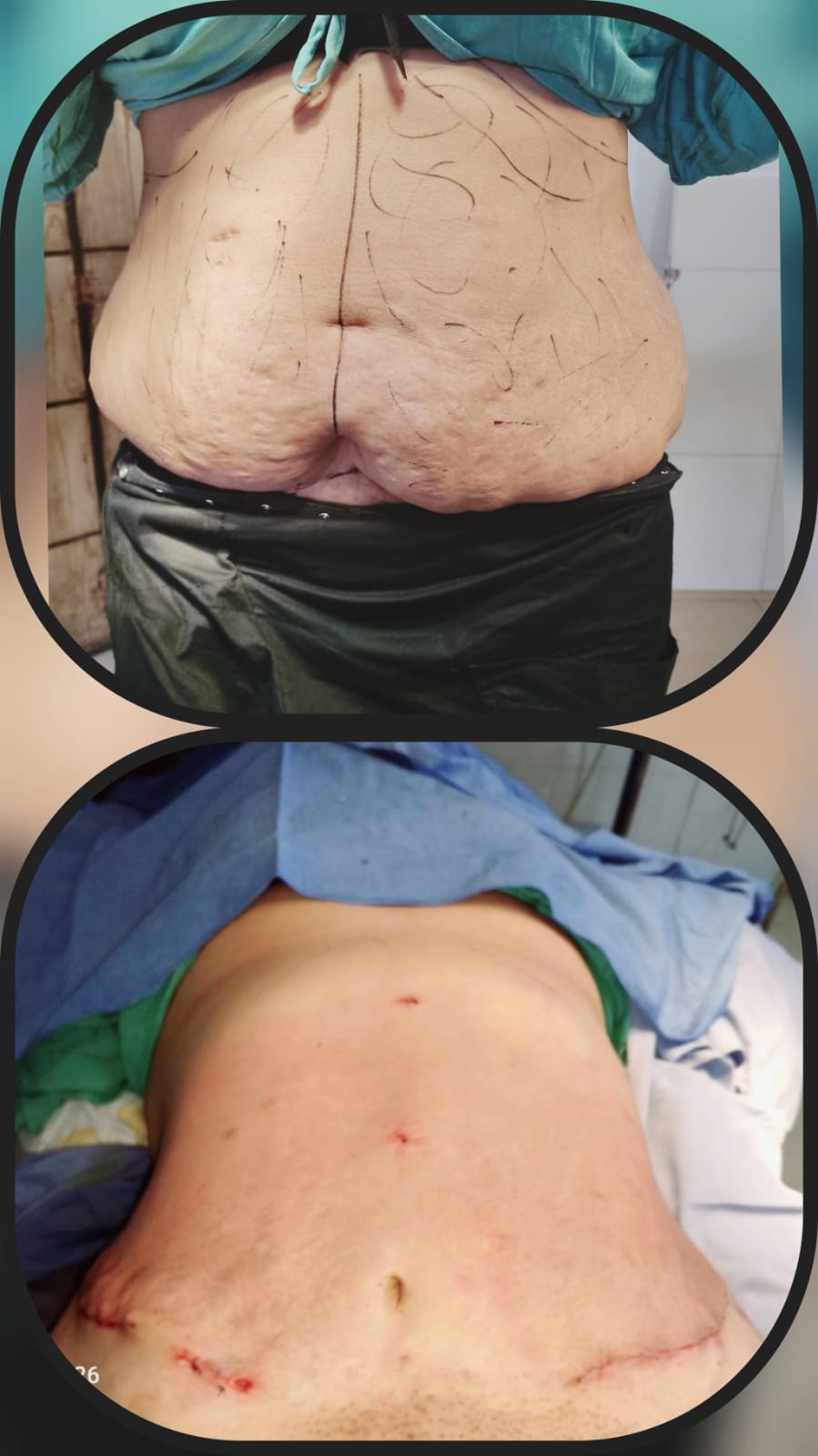 Before & After 27